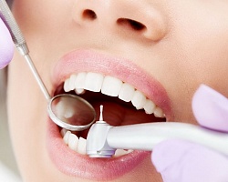 Пломбирование зубов