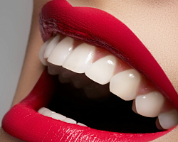 Вредно ли отбеливание зубов в стоматологии